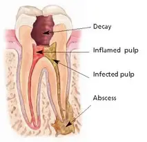 anatomy of tooth